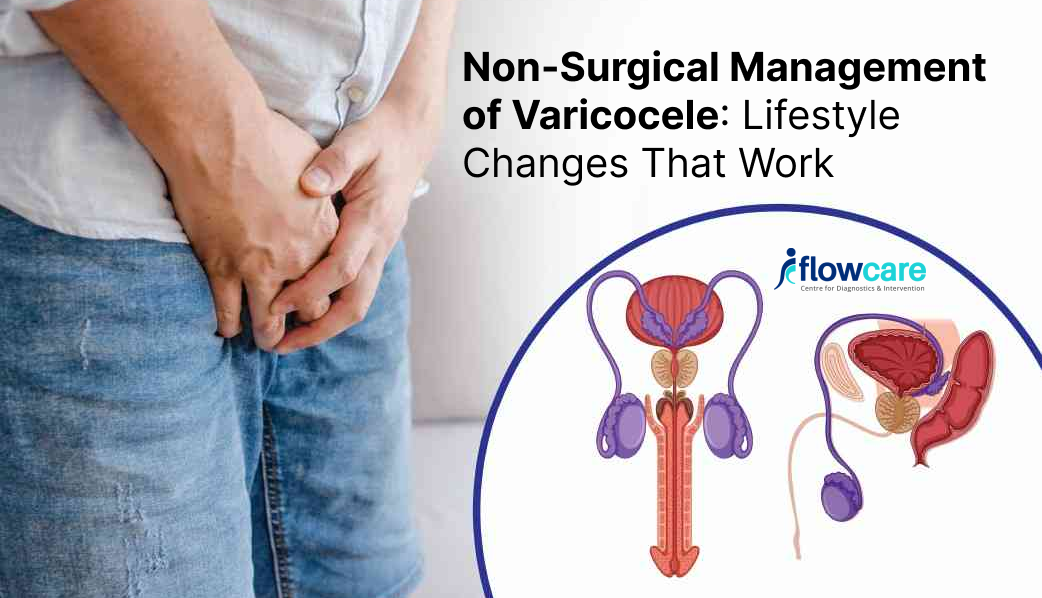 Varicocele Without Surgery: Lifestyle Tips That Actually Work