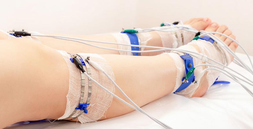 The Role of Compression Therapy in Varicose Vein Management: What