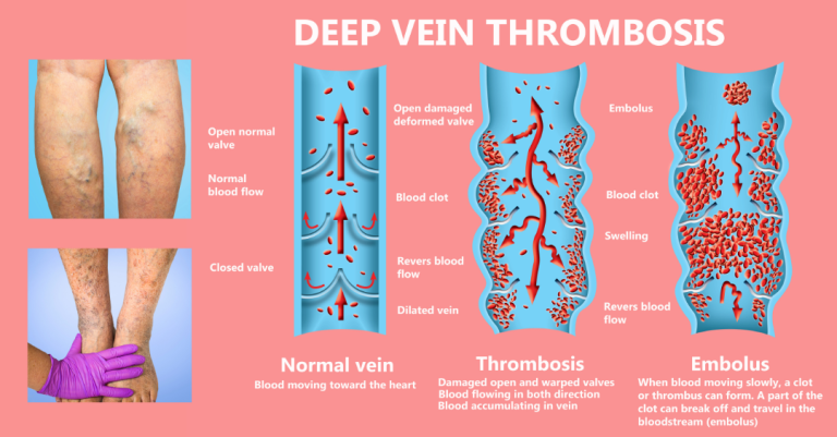 Centre for Diagnosis,Vascular Interventions & Pain Management - Flowcare