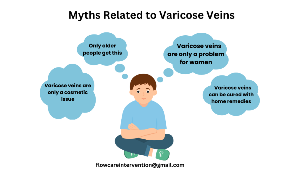 3 Myths About Varicose Veins