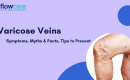 Varicose vein symptoms