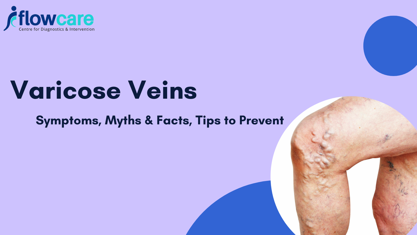 Venous Association of India - Follow these steps and prevent the worsening  of varicose veins. If you are suffering from varicose veins, then you  should try the following tips which will help