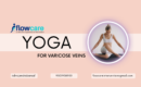 yoga-for-varicose-veins