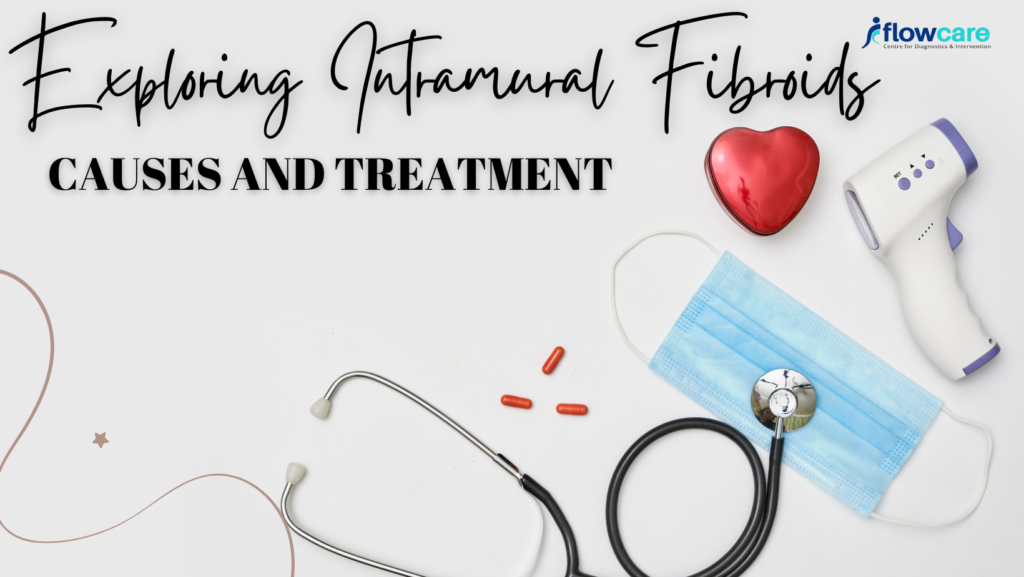 Exploring Intramural Fibroids