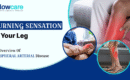 Peripheral Arterial Disease