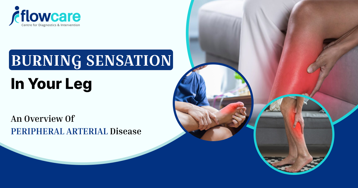Peripheral Arterial Disease