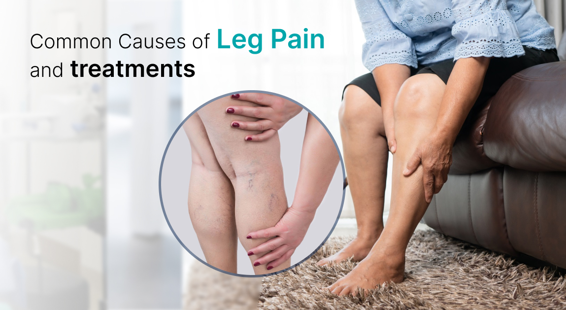 Leg Pain