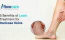 Laser Treatment for Varicose Veins