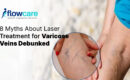 LASER TREATMENT FOR VARICOSE VEINS