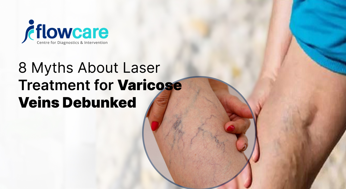 LASER TREATMENT FOR VARICOSE VEINS