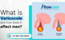 What is Varicocele and How Does It Affect Men