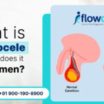 What is Varicocele and How Does It Affect Men
