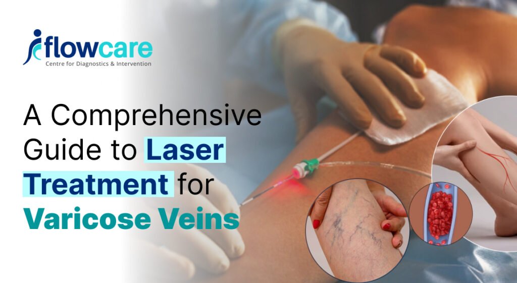 A Comprehensive Guide to Laser Treatment for Varicose Veins