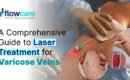 A Comprehensive Guide to Laser Treatment for Varicose Veins