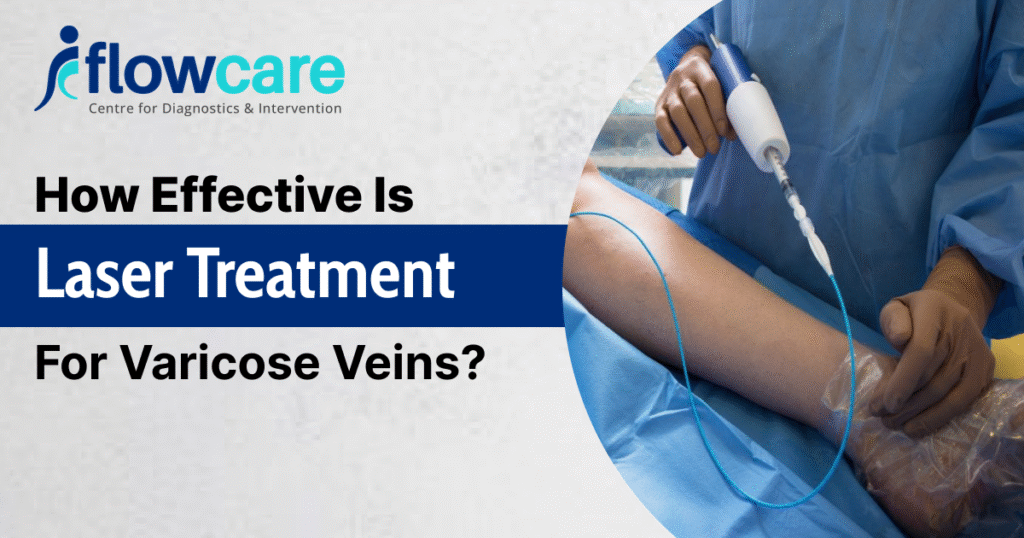 How Effective is Laser Treatment for Varicose Veins?