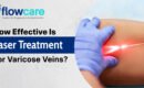 laser Flowcare