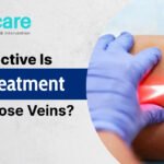 laser Flowcare