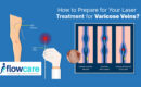 LASER TREATMENT FOR VARICOSE VEINS