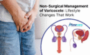 Non-Surgical Management of Varicocele