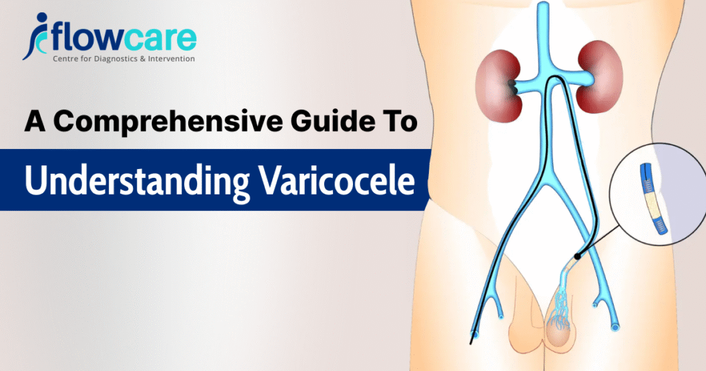 a comprehensive guide to understanding varicocele