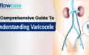 a comprehensive guide to understanding varicocele